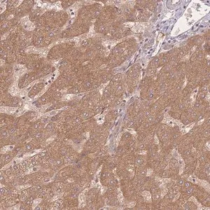 Merck Anti-INSR antibody produced in rabbit