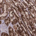 Merck Anti-HOGA1 antibody produced in rabbit