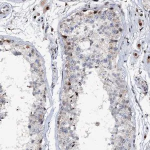 Merck Anti-ABCG4 antibody produced in rabbit