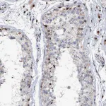 Merck Anti-ABCG4 antibody produced in rabbit