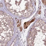 Merck Anti-COG8 antibody produced in rabbit