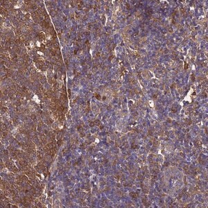 Merck Anti-NME1 antibody produced in rabbit
