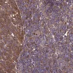 Merck Anti-NME1 antibody produced in rabbit