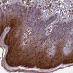 Merck Anti-RASAL1 antibody produced in rabbit