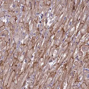 Merck Anti-RRAD antibody produced in rabbit