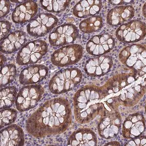 Merck Anti-MVD antibody produced in rabbit