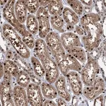 Merck Anti-ZNF169 antibody produced in rabbit