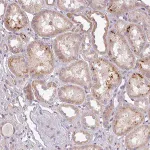 Merck Anti-ZDHHC1 antibody produced in rabbit