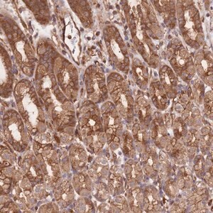 Merck Anti-CCDC140 antibody produced in rabbit