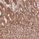 Merck Anti-CCDC140 antibody produced in rabbit