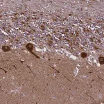 Merck Anti-NDUFS5 antibody produced in rabbit