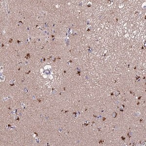 Merck Anti-ACTR5 antibody produced in rabbit