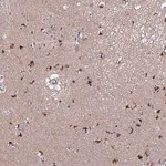 Merck Anti-ACTR5 antibody produced in rabbit