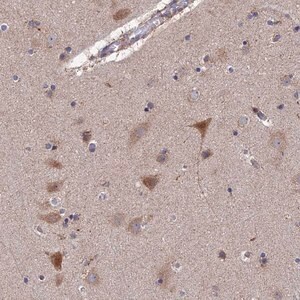 Merck Anti-RIC8B antibody produced in rabbit