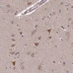 Merck Anti-RIC8B antibody produced in rabbit