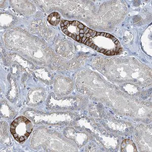 Merck Anti-RASA4 antibody produced in rabbit