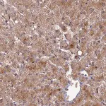 Merck Anti-ADAMTS13 antibody produced in rabbit