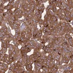 Merck Anti-KANSL1L antibody produced in rabbit