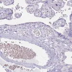 Merck Anti-HBB antibody produced in rabbit