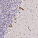 Merck Anti-AADACL4 antibody produced in rabbit