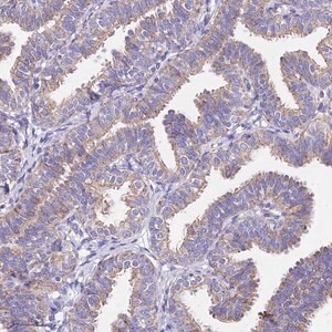 Merck Anti-MRPL3 antibody produced in rabbit