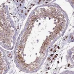 Merck Anti-VPS36 antibody produced in rabbit