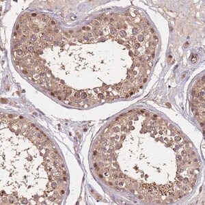 Merck Anti-CDKN2AIPNL antibody produced in rabbit