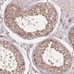 Merck Anti-CDKN2AIPNL antibody produced in rabbit