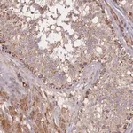 Merck Anti-PTPMT1 antibody produced in rabbit
