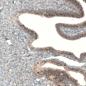 Merck Anti-MRNIP antibody produced in rabbit