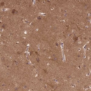 Merck Anti-P2RX7 antibody produced in rabbit