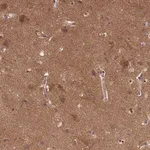 Merck Anti-P2RX7 antibody produced in rabbit