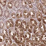 Merck Anti-TP53AIP1 antibody produced in rabbit