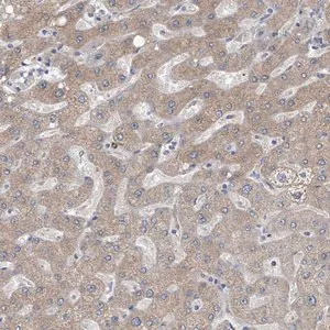 Merck Anti-AKR1C4 antibody produced in rabbit