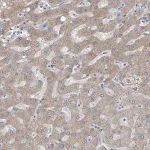 Merck Anti-AKR1C4 antibody produced in rabbit