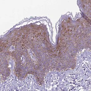 Merck Anti-TRIM51 antibody produced in rabbit