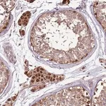 Merck Anti-CCDC112 antibody produced in rabbit