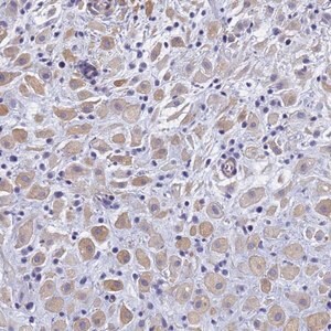 Merck Anti-TRIM64 antibody produced in rabbit