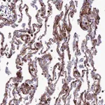 Merck Anti-COL6A6 antibody produced in rabbit