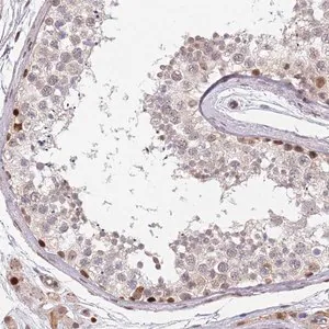 Merck Anti-DPH2 antibody produced in rabbit