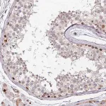 Merck Anti-DPH2 antibody produced in rabbit