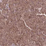 Merck Anti-NPEPPS antibody produced in rabbit