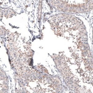 Merck Anti-PPM1J antibody produced in rabbit