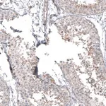 Merck Anti-PPM1J antibody produced in rabbit