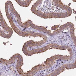 Merck Anti-NPHP1 antibody produced in rabbit
