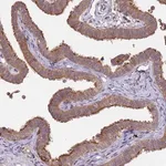 Merck Anti-NPHP1 antibody produced in rabbit