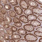 Merck Anti-FOXRED1 antibody produced in rabbit