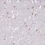 Merck Anti-PTCHD1 antibody produced in rabbit