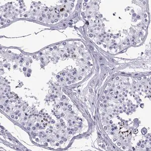 Merck Anti-SPANXC antibody produced in rabbit
