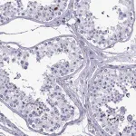 Merck Anti-SPANXC antibody produced in rabbit